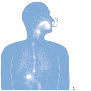 A&eacute;rosol doseur seul