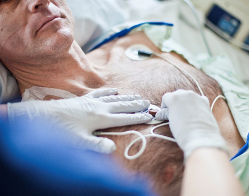 Lutter contre les infections nosocomiales gr&acirc;ce aux c&acirc;bles ECG &agrave; usage unique