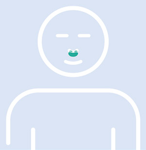 Dessin de l'emplacement d'un masque narinaire sur le visage d'un patient trait&eacute; pour l'apn&eacute;e du sommeil