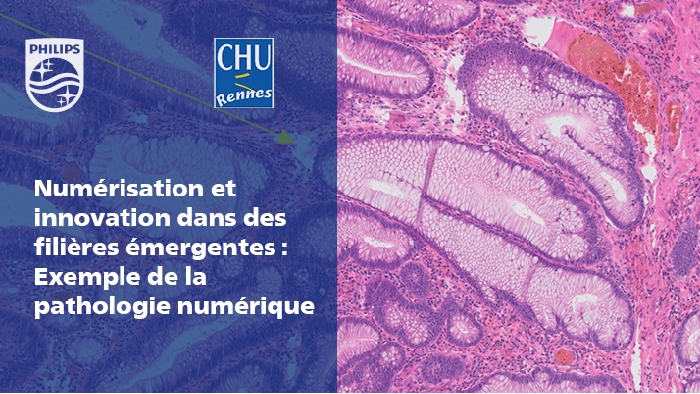 Partage d&rsquo;exp&eacute;rience du