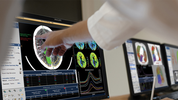 Solutions Philips pour le workflow en Radiologie