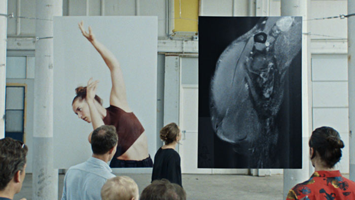 Vid&eacute;o montrant Philips &agrave; la r&eacute;union de la RSNA de 2021