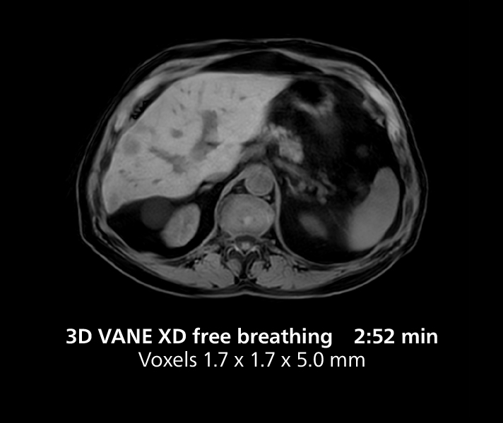 Irm du genou une mri