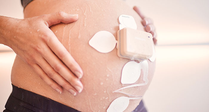 une femme enceinte avec un appareil attach&eacute; &agrave; son ventre