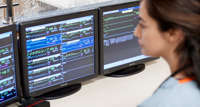 Miniature &ndash; Fatigue li&eacute;e aux alarmes