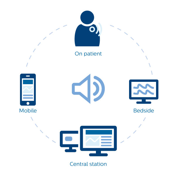 un sch&eacute;ma d'un appareil