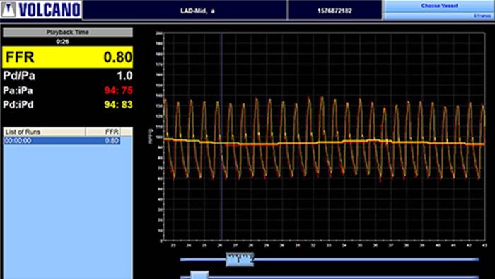 &Eacute;cran ffr de la modalit&eacute; ifr