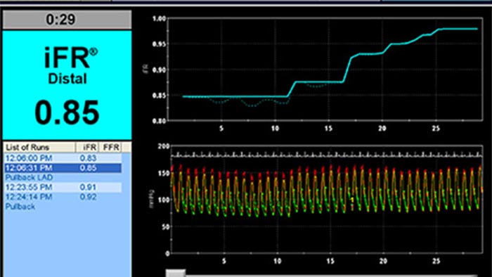 &Eacute;cran ifr de la modalit&eacute;
