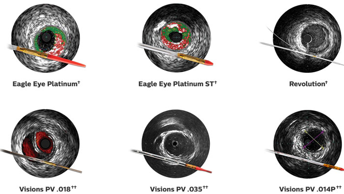 Cath&eacute;ters pour &eacute;chographie intravasculaire