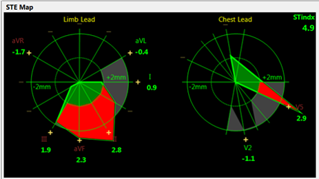 Carte de d&eacute;pistage