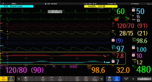 &Eacute;cran de donn&eacute;es avec des chiffres