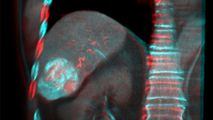 Fusion d&rsquo;images avec double affichage