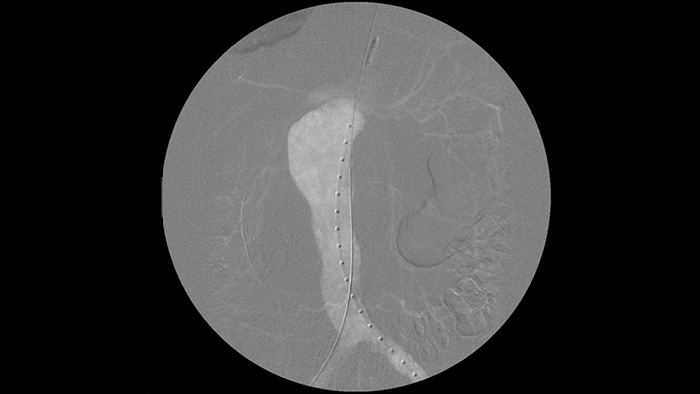 Options de contraste &agrave; base d&rsquo;iode et de CO2
