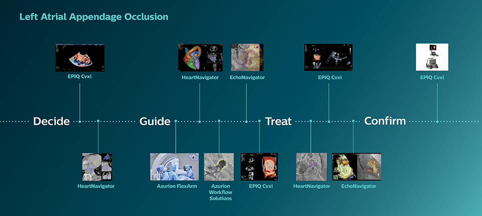 Occlusion de l&rsquo;appendice auriculaire gauche
