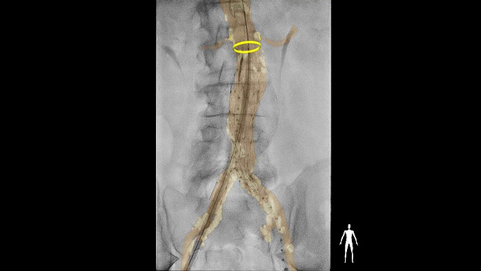 Contact responsable de la suite d&eacute;di&eacute;e au vasculaire