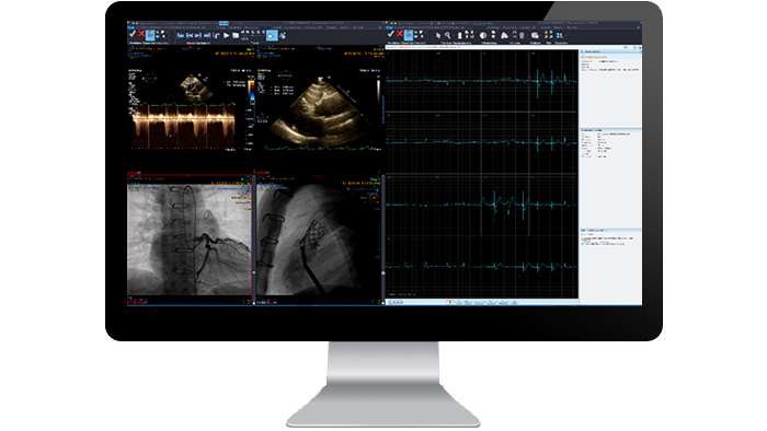 &Eacute;cran d&rsquo;interface du module de cardiologie sur un moniteur
