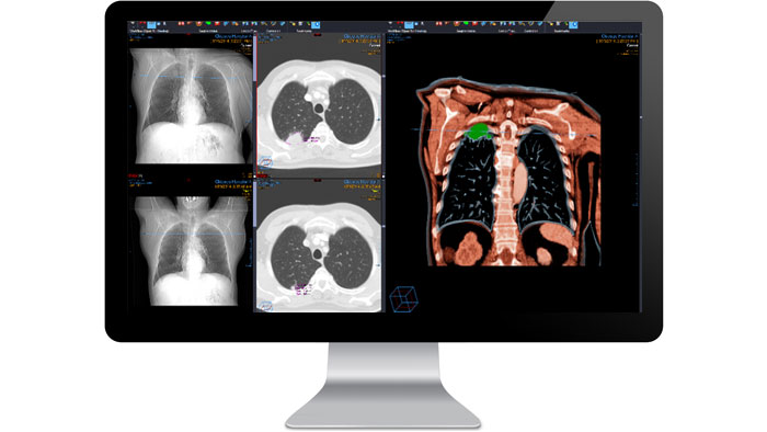 &Eacute;cran d&rsquo;interface du module de diagnostic de radiologie sur un moniteur