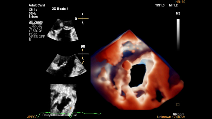 X5 1C Examen d&rsquo;imagerie Truevue