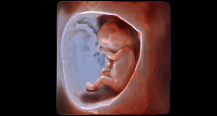 un f&oelig;tus dans un ut&eacute;rus