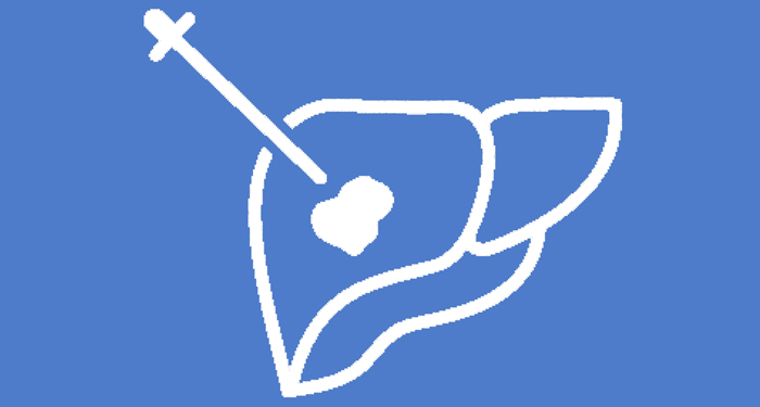 ic&ocirc;ne repr&eacute;sentant fusion images et navigation visualisation aiguilles