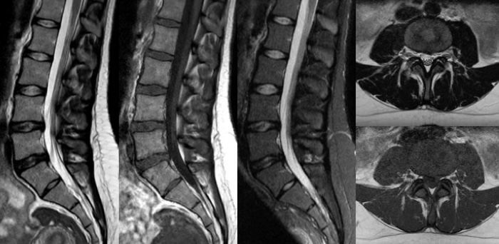 Miniature &ndash; Seize minutes
