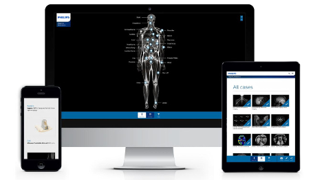Cartographie anatomique IRM