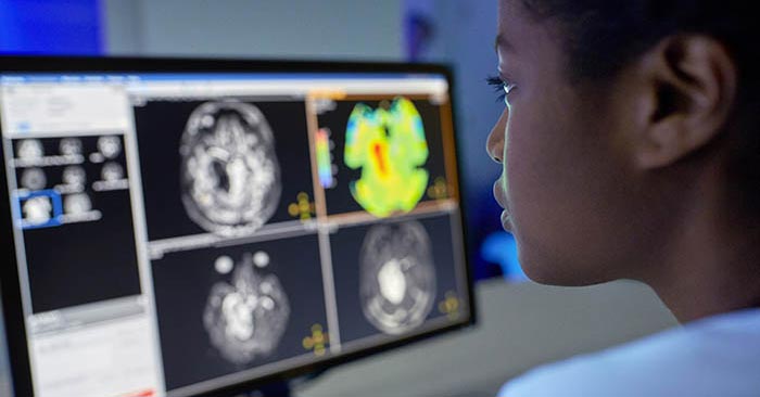 am&eacute;liorer la cadence des examens