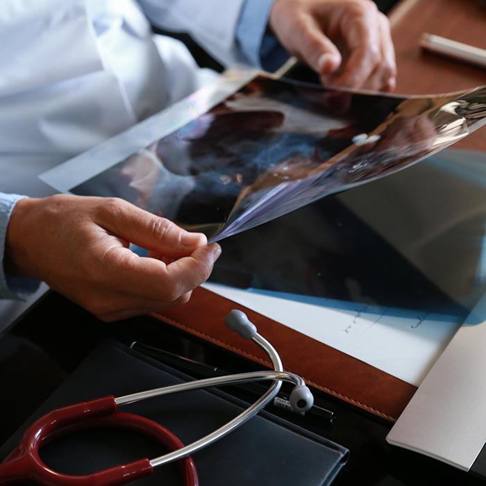 radiologie et st&eacute;thoscope