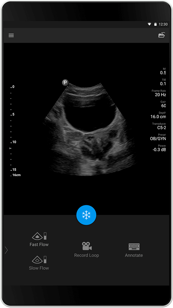 Examen gyn&eacute;cologique/obst&eacute;trique C5-2