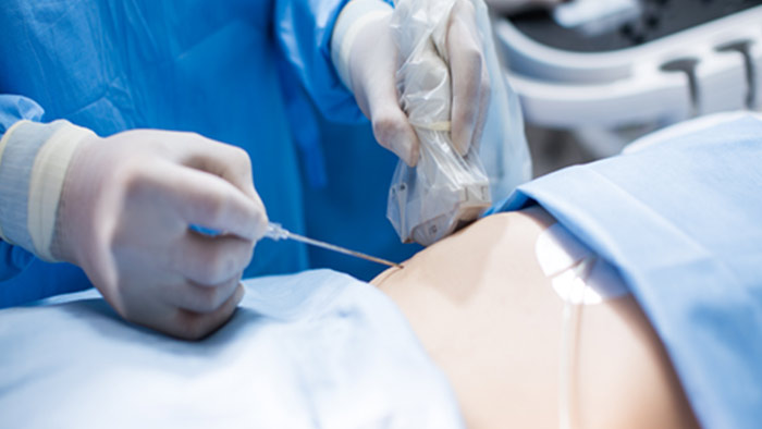 navigation avec visualisation de l&rsquo;aiguille