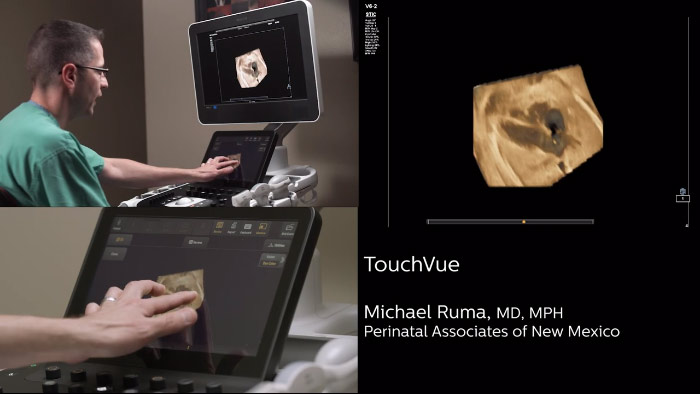 D&eacute;monstration de MPR Touch