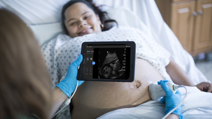 Une qualit&eacute; d&rsquo;image de qualit&eacute;