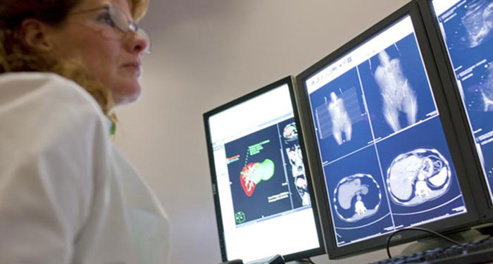 Imagerie Mol&eacute;culaire Avanc&eacute;e