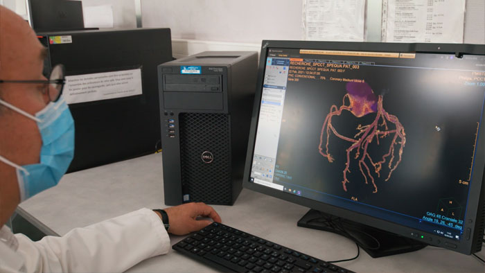T&eacute;moignage Scanner &agrave; d&eacute;tection spectrale