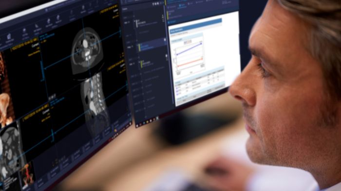 Solutions informatiques en radiologie