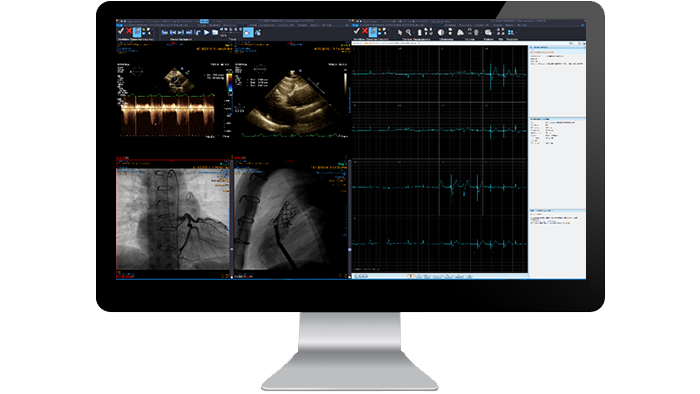 &Eacute;cran d&rsquo;interface du module de cardiologie sur un moniteur