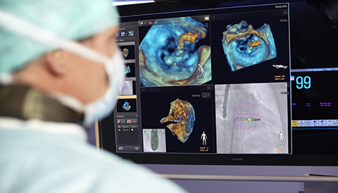 Traitement des cardiopathies structurelles via l&rsquo;imagerie guid&eacute;e