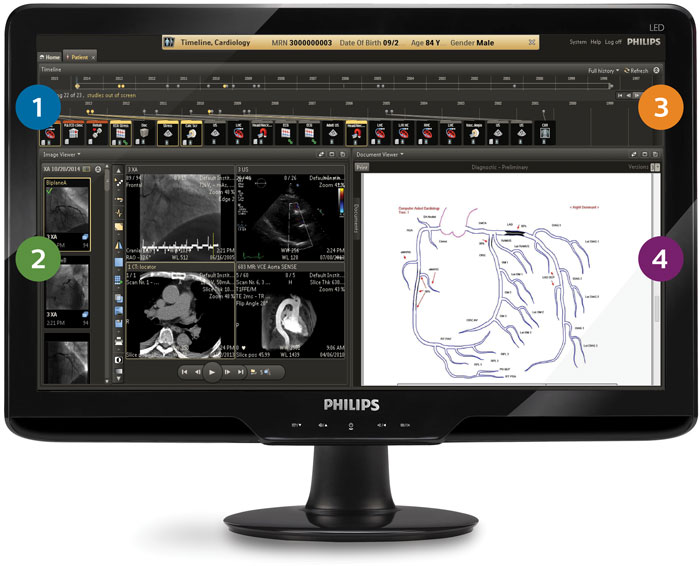 un &eacute;cran d'ordinateur avec une capture d'&eacute;cran d'un scanner cardiaque