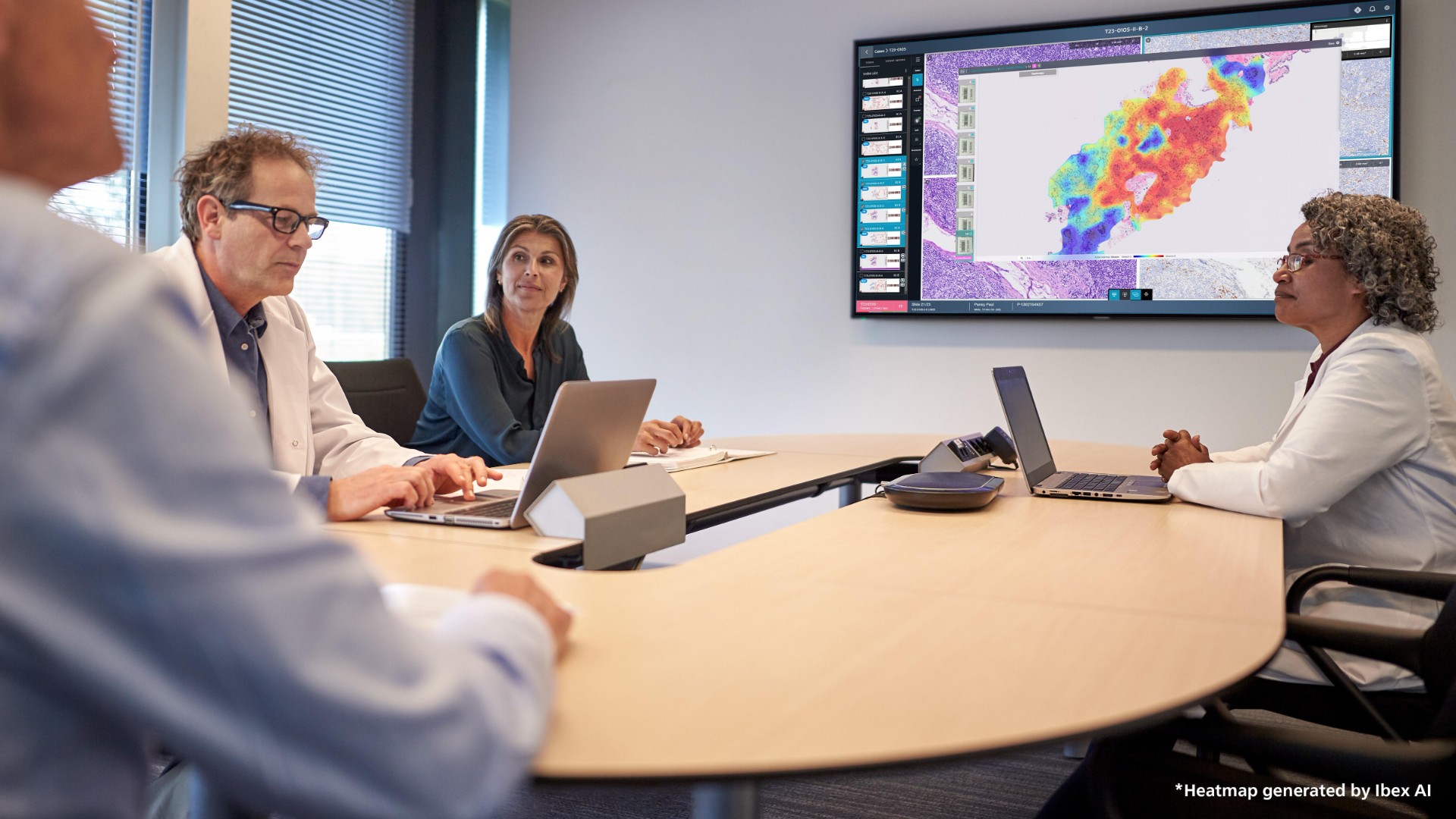 Philips et Ibex renforcent leur partenariat pour des workflows de pathologie plus efficaces et centr&eacute;s sur le patient